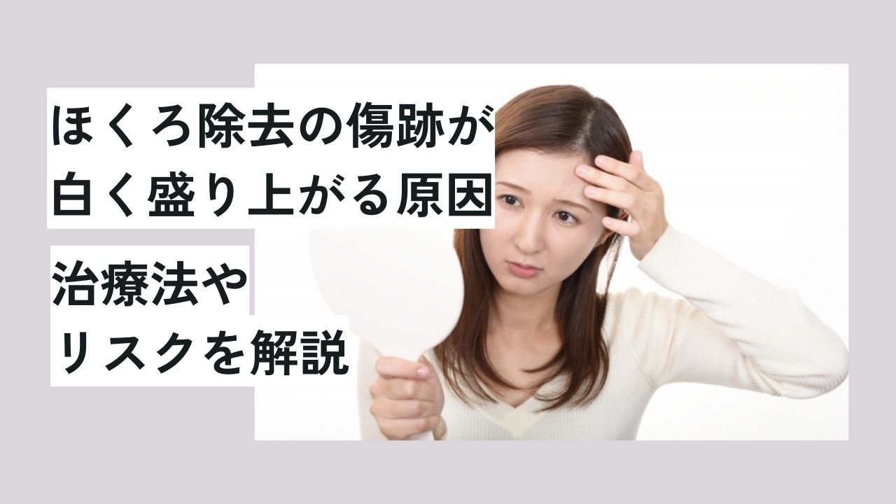 ほくろ除去の傷跡が白く盛り上がる原因｜治療法やリスクを解説